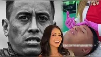 Christian Cueva deja EN SHOCK al someterese a INTERVENCIÓN en el rostro y sorprende con resultados: "Cueva más guapo"