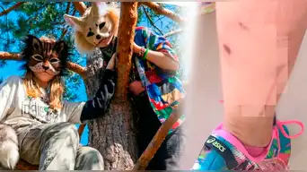 ¡Menor fue MORDIDA por THERIAN! MADRE denuncia que su hija fue MORDIDA por jóvenes que se creen ANIMALES: "Pensó que estaban bromeando"