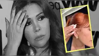 Magaly Medina REVELA que perdió SENSIBILIDAD en su oreja tras realizarse cirugía facial en Argentina: "No pensaba hablar..."