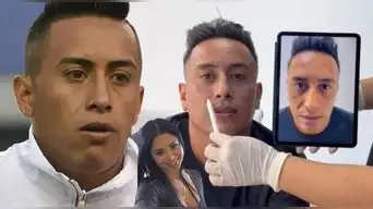 Christian Cueva se somete a tratamiento de MASCULINIZACIÓN por IMPENSADO motivo y muestra los resultados: "Me veía al espejo y..."