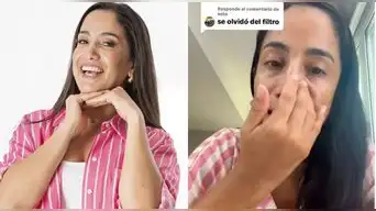 ¡SIN FILTROS NI MIEDO! Nelly Rossinelli sorprende al revelar sus imperfecciones y la verdad detrás de su piel