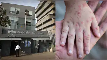 ¿Se suspenderán las clases? Perú registra más de 300 contagios de virus Coxsackie en colegios: esto dice Minedu