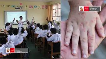 Minedu y Minsa activan protocolos tras más de 140 casos de virus Coxsackie en colegios: padres deberán cumplir medidas