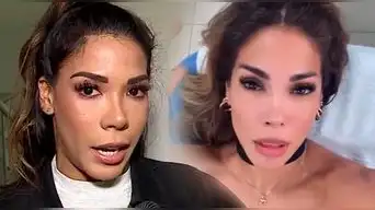 Karen Dejo se mostró PREOCUPADA al descubrir que tiene un hueco en el cabello y revela DIAGNÓSTICO: "Te ataca"