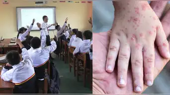 Colegios SUSPENDEN CLASES por brote de SARAMPIÓN en esta ciudad peruana: estudiantes vuelven a virtualidad
