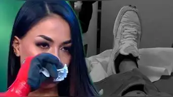 Onelia Molina sufrió FUERTE ACCIDENTE y terminó con puntos en la pierna tras lesionarse: “Una raya más al tigre"