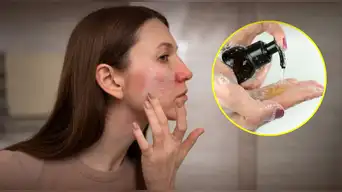 Indecopi RETIRA del mercado peruano famosa marca de LIMPIADOR FACIAL por presencia de bacterias