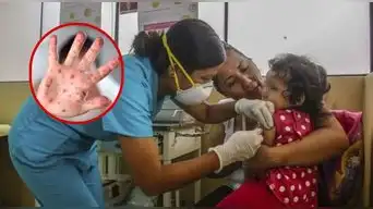 ¡ALERTA por sarampión! Minsa amplía EMERGENCIA SANITARIA por 90 días: estas son las regiones en RIESGO