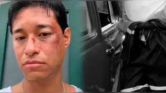 Tony Succar PREOCUPA al aparecer con MORETONES en todo el rostro y revela su ESTADO: "Pudo haber sido peor..."