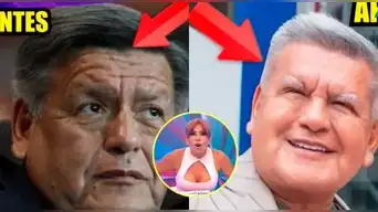 Magaly Medina queda en shock con el NUEVO ROSTRO de César Acuña tras someterse a unos ‘RETOQUITOS’ y lanza polémico comentario: “Le han hecho…”