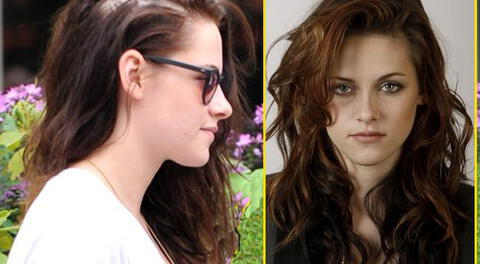 Kristen Stewart sufre un severo problema de caída de cabello