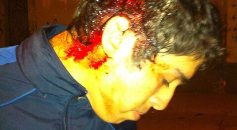 Rashyd Ramal Gomes el basquetbolista agredido