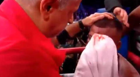 Pacquiao vs Broner: El terrible corte que sufrió Badou Jack en la pelea preliminar