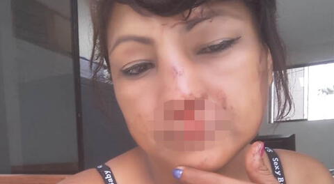 Otra mujer fue víctima de cobarde agresión en Jicamarca