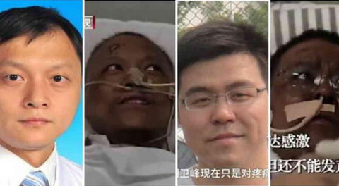 Médicos de China tienen extraño cambio de color en la piel tras sobrevivir al coronavirus	.