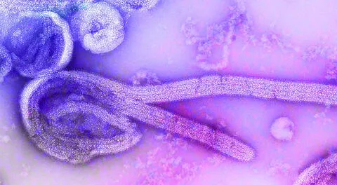 El Chapare puede ser confundido con el ébola, o incluso dengue.
