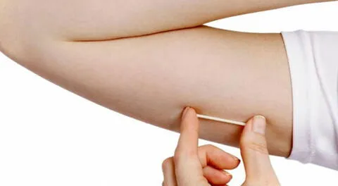 Más de 36 mil mujeres a nivel nacional pueden acceder al implante subdérmico gratis
