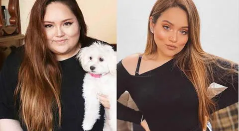 Susan Prieto revela que tras perder más de 50 kilos necesita de una abdominoplastia