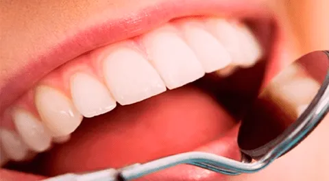 Conoce en esta nota el significado que tiene el que sueñes que a otra persona se le caen los dientes.