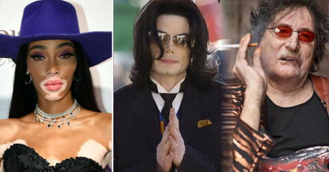 Michael Jackson y algunos famosos que aprendieron a vivir con Vitíligo