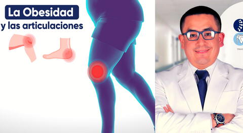 La obesidad puede estar dañando tus articulaciones