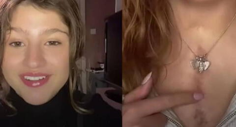 Sorprendente. La joven reveló a través de su cuenta de TikTok cómo se ve le operación hoy en día.