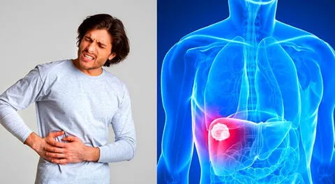 Si tienes algunos de estos síntomas debes acudir al médico para hacerlos examenes de descarte.