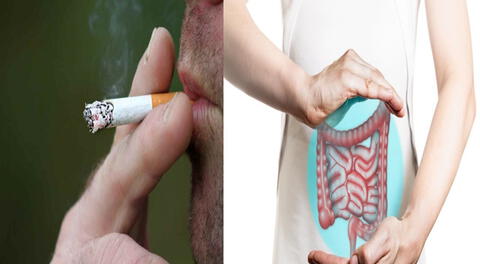 Aprende sobre los riesgos de ser fumador y desarrollar cáncer al colon