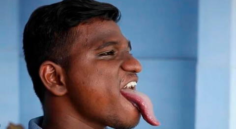 La longitud de su lengua le ha permitido desarrollar todo tipo de habilidades como tocarse el codo y la nariz con la lengua.