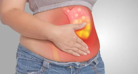 El cáncer de estómago, también conocido como cáncer gástrico, puede atacar cualquier parte del estómago.