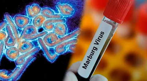 Conoce detalles del virus de Marburgo.