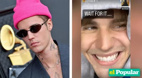 Justin Bieber vuelve a sonreir en Instagram tras complicaciones de rara enfermedad