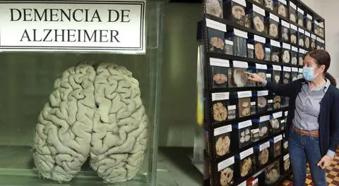 Muestras de cerebros de museo en Barrios Altos.
