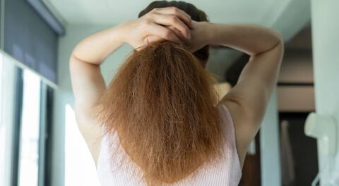 El cabello seco puede simbolizar un serio problema en el cuero cabelludo.