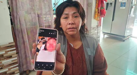 Madre de familia señala que los rostros de sus hijas presentan infección y pide que intervengan clínica.