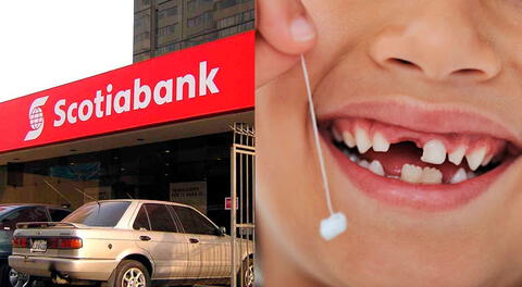 Campaña diente de leche fue abierto por Scotiabank del 15 al 31 de agosto.