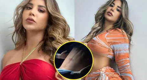 Gabriela Serpa se somete a liposucción y remodelación de costillas.