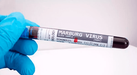 Cómo se transmite el virus de Marburgo y cuáles son los síntomas, según la OMS