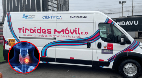 La primera movilidad en el Perú que llevará despistajes gratuitos para la detección de enfermedades tiroideas.