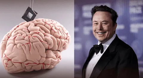 Elon Musk promete devolver la visión con chips cerebrales de Neuralink.