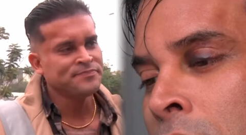 Christian Domínguez enciende las ALARMAS al reaparecer con el ojo morado y el rostro diferente ¿Qué pasó?