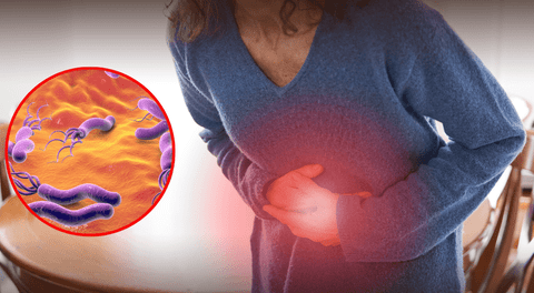 Esta es la bacteria peligrosa asociada al cáncer de estómago, según científicos.