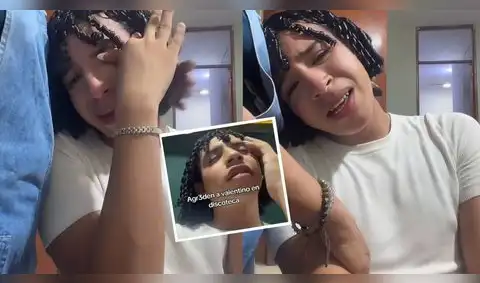 Valentino Palacios denuncia fuerte agresión contra él y su hermano.