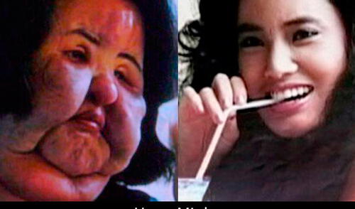 Ex modelo Hang Mioku y su tragedia personal: se inyectó aceite de cocina en el rostro. elpopular.pe