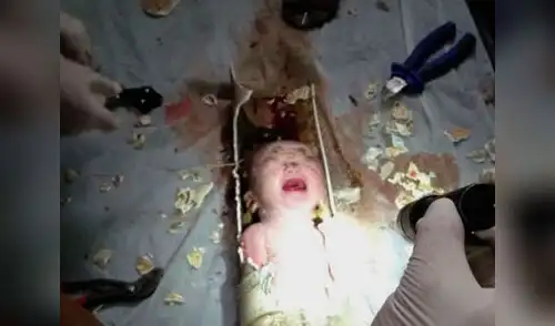 Bebé es rescatado luego de estar atrapado en tubería, en China. elpopular.pe