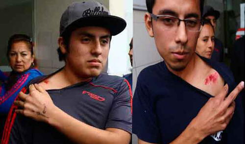 Heridos fueron trasladados al hospital Sergio Bernales, donde se recuperan. elpopular.pe