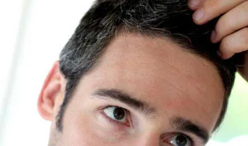 Las canas también aparecen en los jóvenes. elpopular.pe