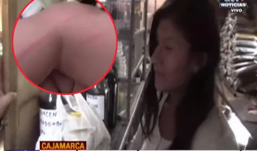 Mujer se justificó tras la golpear a su menor hijo. elpopular.pe