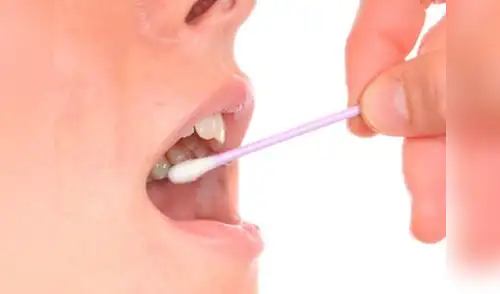 Te sorprenderás, todo lo que pueden hallar en un análisis de saliva elpopular.pe