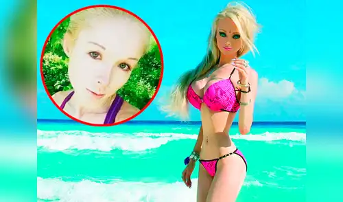 La barbie humana invirtió varios miles de dólares en operaciones elpopular.pe